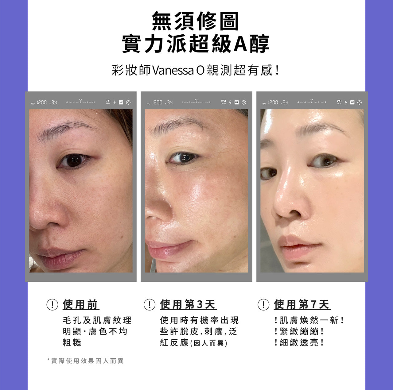 MIRAE +RETINOL 3X PLUS+ Super Serum - 30ml