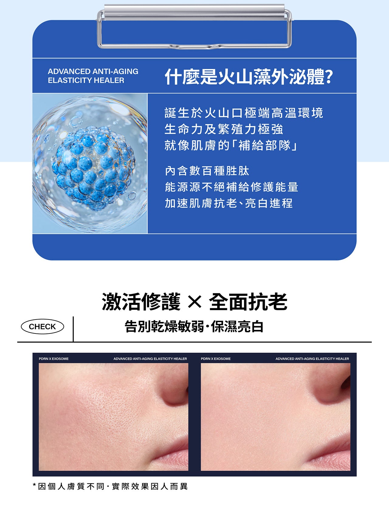 MIRAE PDRN X Exosome 12000 Spicule Serum - 15ml + 15ml